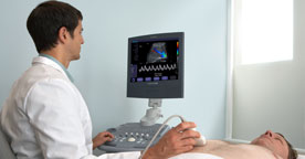 ACUSON X150 ultrasound system